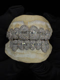 Custom Grillz (Deposit)